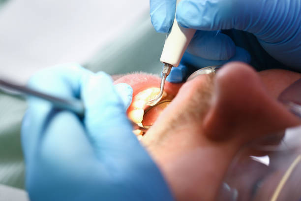 Best After-Hours Dental Trauma Care in Randolph Af, TX